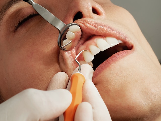 Rewolucja w Stomatologii: Implant Zęba- Lublin: Nowoczesne Rozwiązanie dla Utraty Zębów
